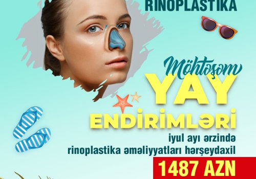 Mohtesem YAY ENDIRIMLERI!!!
